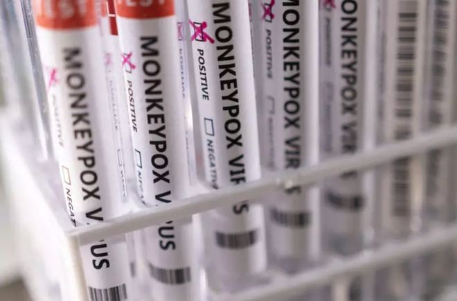 加拿大境內(nèi)的猴痘確診病例已經(jīng)達到77例